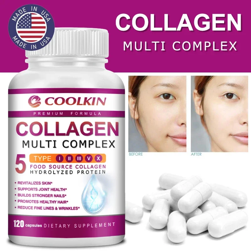Collagen Multi Complex - ประเภ - Coffee X บทวิจารณ์และราคา